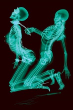 ЦЮПКА ИВАН — Із серії X-ray professional photo, 2011